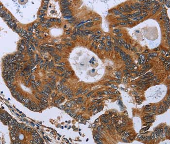 Immunohistochemistry (Formalin/PFA-fixed paraffin-embedded sections) - Anti-Growth hormone antibody (AB198007)