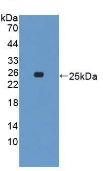 Western blot - Anti-Growth Hormone antibody (AB230996), expandable thumbnail