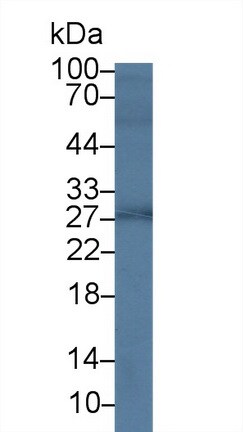 Western blot - Anti-Growth Hormone antibody (AB230996), expandable thumbnail