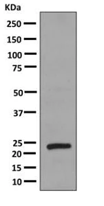 Western blot - Anti-Growth Hormone antibody [EPR11047(B)] (AB155276)