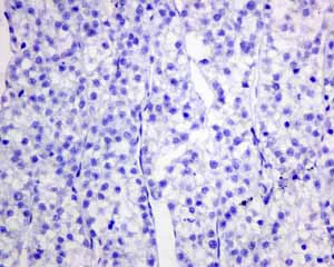Immunohistochemistry (Formalin/PFA-fixed paraffin-embedded sections) - Anti-Growth Hormone antibody [EPR11047(B)] - BSA and Azide free (AB240133)