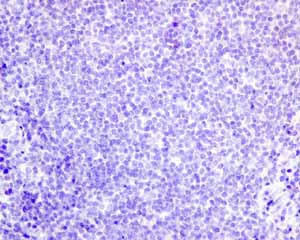 Immunohistochemistry (Formalin/PFA-fixed paraffin-embedded sections) - Anti-Growth Hormone antibody [EPR11047(B)] - BSA and Azide free (AB240133)