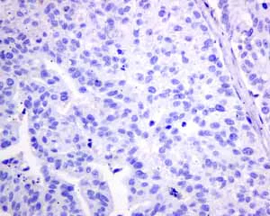 Immunohistochemistry (Formalin/PFA-fixed paraffin-embedded sections) - Anti-Growth Hormone antibody [EPR11047(B)] - BSA and Azide free (AB240133)