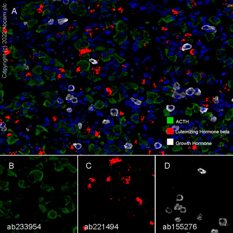 Multiplex immunohistochemistry - Anti-Growth Hormone antibody [EPR11047(B)] - BSA and Azide free (AB240133)