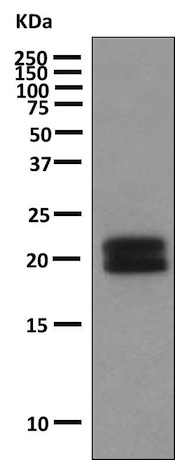 Western blot - Anti-Growth Hormone antibody [EPR9524-21] (AB155975)