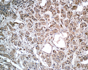 Immunohistochemistry (Formalin/PFA-fixed paraffin-embedded sections) - Anti-Growth Hormone antibody [EPR9524] (AB155974), expandable thumbnail