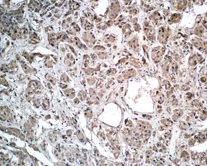 Immunohistochemistry (Formalin/PFA-fixed paraffin-embedded sections) - Anti-Growth Hormone antibody [EPR9524] (AB155974)