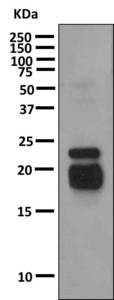 Western blot - Anti-Growth Hormone antibody [EPR9524] (AB155974), expandable thumbnail