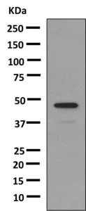 Western blot - Anti-Growth Hormone antibody [EPR9524] (AB155974)