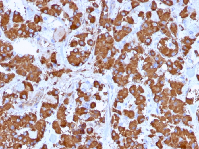 Immunohistochemistry (Formalin/PFA-fixed paraffin-embedded sections) - Anti-Growth Hormone antibody [GH/1371] (AB218404), expandable thumbnail