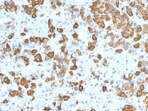 Immunohistochemistry (Formalin/PFA-fixed paraffin-embedded sections) - Anti-Growth Hormone antibody [GH/1371] (AB218404)