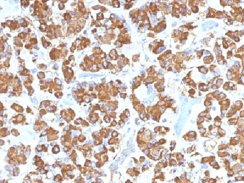 Immunohistochemistry (Formalin/PFA-fixed paraffin-embedded sections) - Anti-Growth Hormone antibody [GH/1450] (AB218405)