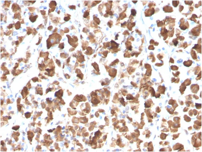 Immunohistochemistry (Formalin/PFA-fixed paraffin-embedded sections) - Anti-Growth Hormone antibody [GH/3155] (AB268066)