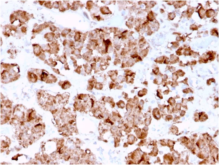 Immunohistochemistry (Formalin/PFA-fixed paraffin-embedded sections) - Anti-Growth Hormone antibody [GH/3155] (AB268066)