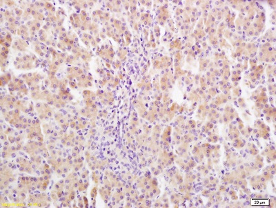 Immunohistochemistry (Formalin/PFA-fixed paraffin-embedded sections) - Anti-Growth hormone receptor antibody (AB202964), expandable thumbnail