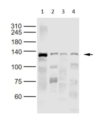 Western blot - Anti-Growth hormone receptor antibody (AB202964)