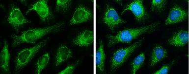 Immunocytochemistry/ Immunofluorescence - Anti-Grp75/MOT antibody (AB227215), expandable thumbnail