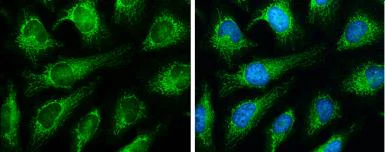 Immunocytochemistry/ Immunofluorescence - Anti-Grp75/MOT antibody (AB227215)