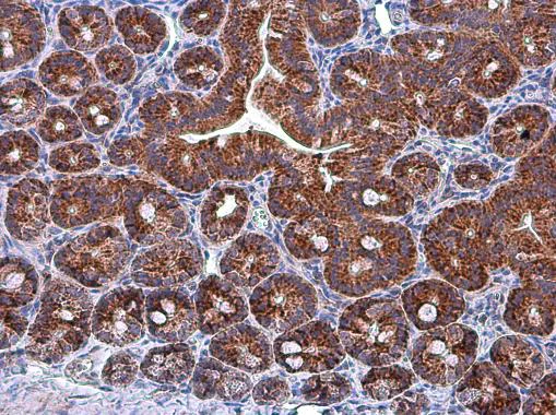 Immunohistochemistry (Formalin/PFA-fixed paraffin-embedded sections) - Anti-Grp75/MOT antibody (AB227215)