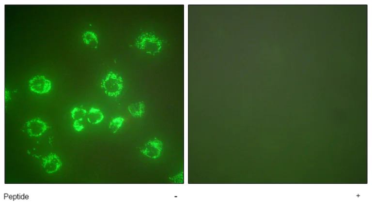 Immunocytochemistry/ Immunofluorescence - Anti-Grp75/MOT antibody (AB53098)
