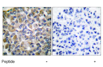 Immunohistochemistry (Formalin/PFA-fixed paraffin-embedded sections) - Anti-Grp75/MOT antibody (AB53098)