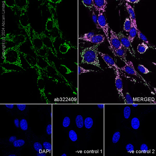 Immunocytochemistry/ Immunofluorescence - Anti-Grp75/MOT antibody [EPR29618-542] (AB322409)