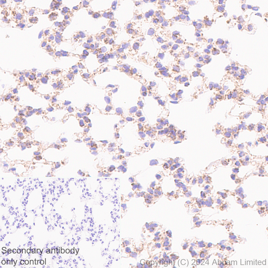 Immunohistochemistry (Formalin/PFA-fixed paraffin-embedded sections) - Anti-Grp75/MOT antibody [EPR29618-542] (ab322409), expandable thumbnail