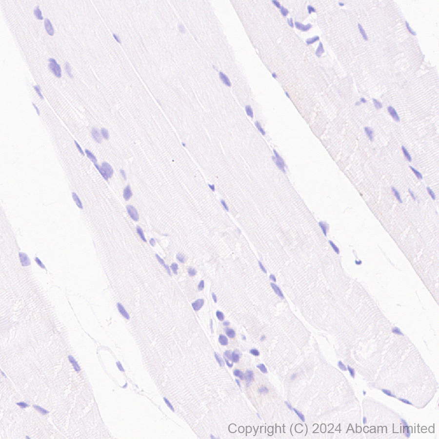 Immunohistochemistry (Formalin/PFA-fixed paraffin-embedded sections) - Anti-Grp75/MOT antibody [EPR29618-542] (ab322409), expandable thumbnail