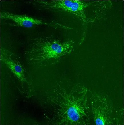 Immunocytochemistry/ Immunofluorescence - Anti-Grp75/MOT antibody [JG1] (AB2799)