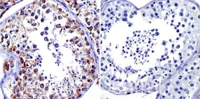 Immunohistochemistry (Formalin/PFA-fixed paraffin-embedded sections) - Anti-Grp75/MOT antibody [JG1] (AB2799)