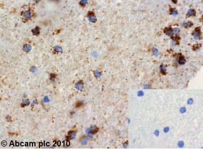 Immunohistochemistry (Formalin/PFA-fixed paraffin-embedded sections) - Anti-Grp75/MOT antibody [JG1] (ab2799), expandable thumbnail