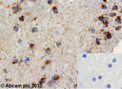 Immunohistochemistry (Formalin/PFA-fixed paraffin-embedded sections) - Anti-Grp75/MOT antibody [JG1] (AB2799)