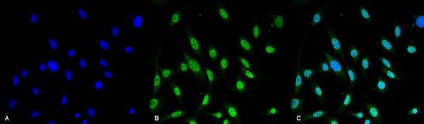 Immunocytochemistry/ Immunofluorescence - Anti-GRP78 BiP antibody [3C5-1A4] (AB212054)