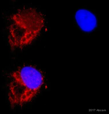Anti-GRP78 BiP antibody. Rabbit polyclonal (ab21685) | Abcam