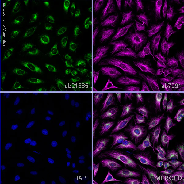Anti-GRP78 BiP antibody. Rabbit polyclonal (ab21685) | Abcam