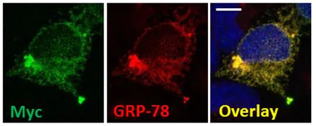 Immunocytochemistry/ Immunofluorescence - Anti-GRP78 BiP antibody (AB21685)