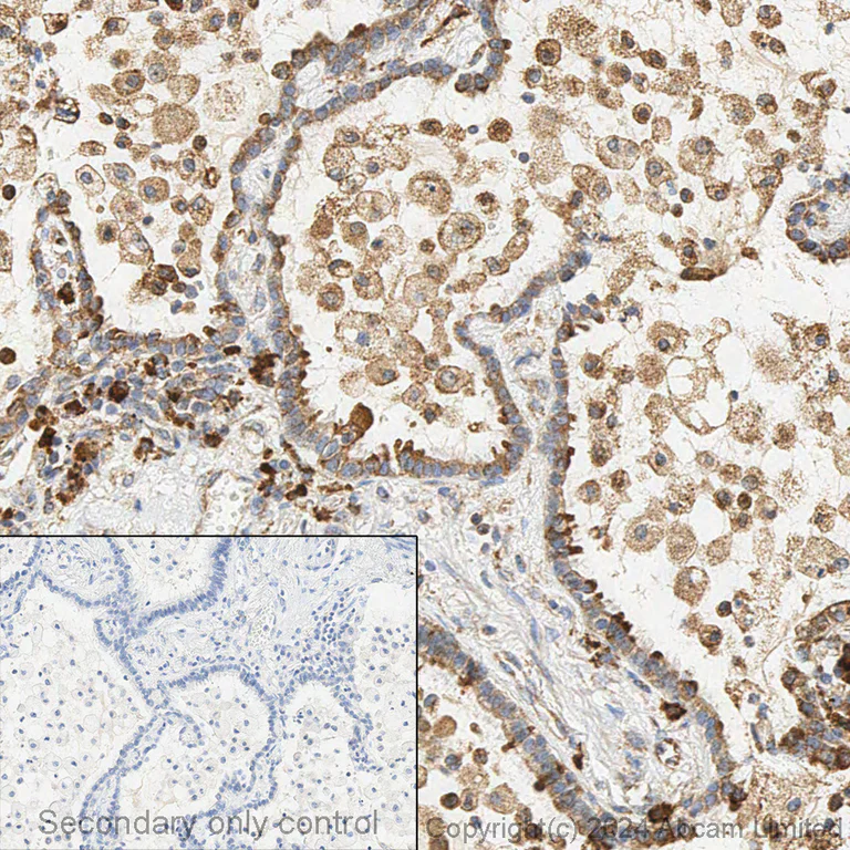 Anti-GRP78 BiP antibody. Rabbit polyclonal (ab21685) | Abcam