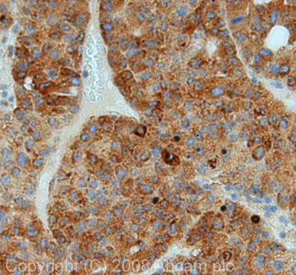 Immunohistochemistry (Formalin/PFA-fixed paraffin-embedded sections) - Anti-GRP78 BiP antibody (AB21685)