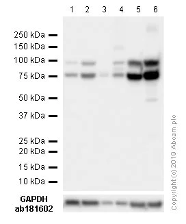 Western blot - Anti-GRP78 BiP antibody (AB21685)