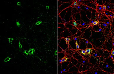 Immunocytochemistry/ Immunofluorescence - Anti-GRP78 BiP antibody (AB227865)