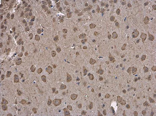 Immunohistochemistry (Formalin/PFA-fixed paraffin-embedded sections) - Anti-GRP78 BiP antibody (AB227865)