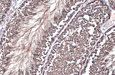Immunohistochemistry (Formalin/PFA-fixed paraffin-embedded sections) - Anti-GRP78 BiP antibody (AB227865)