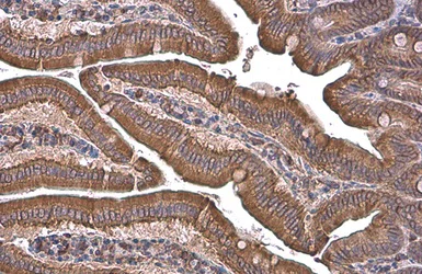 Immunohistochemistry (Formalin/PFA-fixed paraffin-embedded sections) - Anti-GRP78 BiP antibody (AB227865)