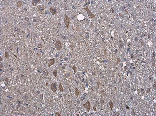 Immunohistochemistry (Formalin/PFA-fixed paraffin-embedded sections) - Anti-GRP78 BiP antibody (AB227865)