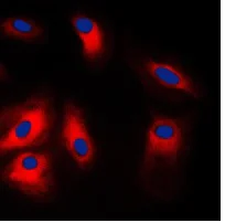 Immunocytochemistry/ Immunofluorescence - Anti-GRP78 BiP antibody (AB230508)