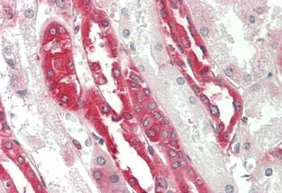 Immunohistochemistry (Formalin/PFA-fixed paraffin-embedded sections) - Anti-GRP78 BiP antibody (AB230508)