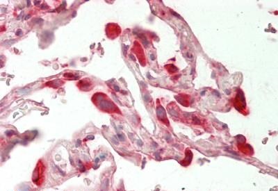 Immunohistochemistry (Formalin/PFA-fixed paraffin-embedded sections) - Anti-GRP78 BiP antibody (AB230508)