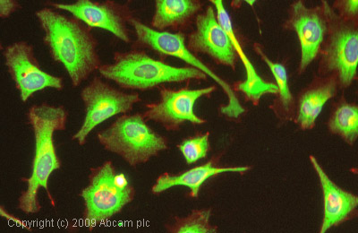 Immunocytochemistry/ Immunofluorescence - Anti-GRP78 BiP antibody (AB32618)