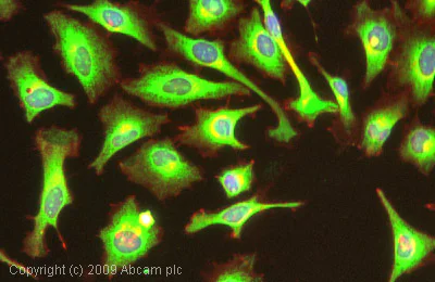 Immunocytochemistry/ Immunofluorescence - Anti-GRP78 BiP antibody (AB32618)