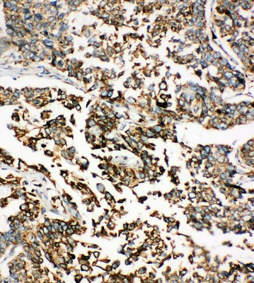 Immunohistochemistry (Formalin/PFA-fixed paraffin-embedded sections) - Anti-GRP78 BiP antibody - C-terminal (AB191023)